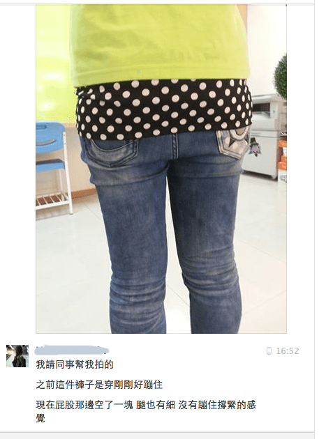 [塑身]埋線五次穿不下褲子褲子變鬆-好友爆爆埋線分享。