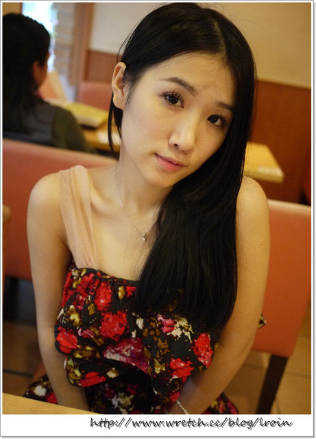 <醫美>小腿肉毒三月成果分享